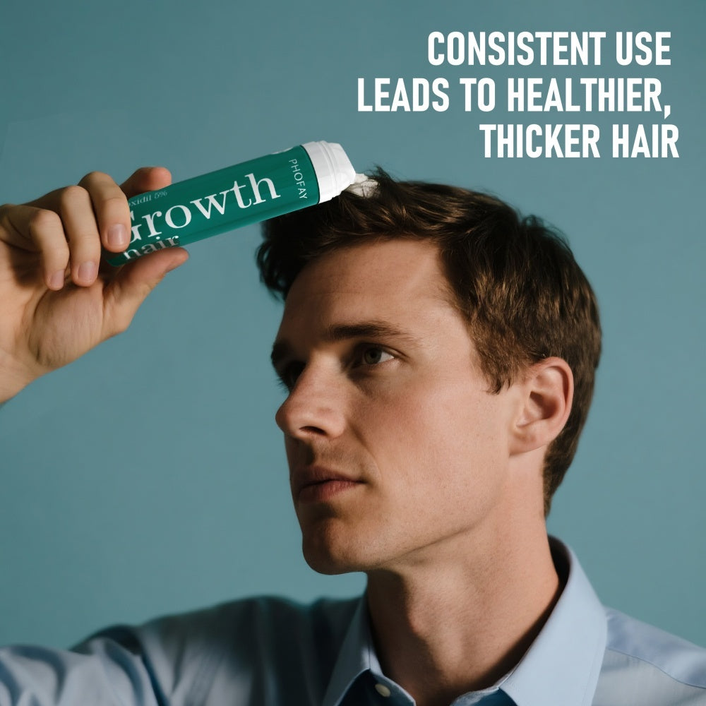 CH004 Minoxidil Anti-Hair Loss Mousse - Bests Sale